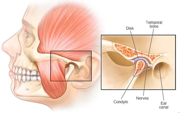Why Do My Teeth Hurt When I Wake Up?