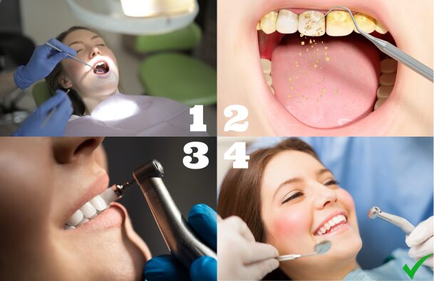 process of teeth cleaning