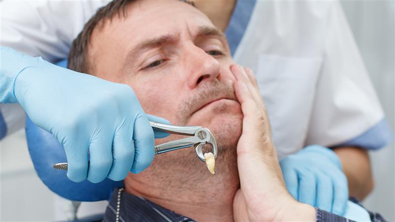 Teeth Extraction