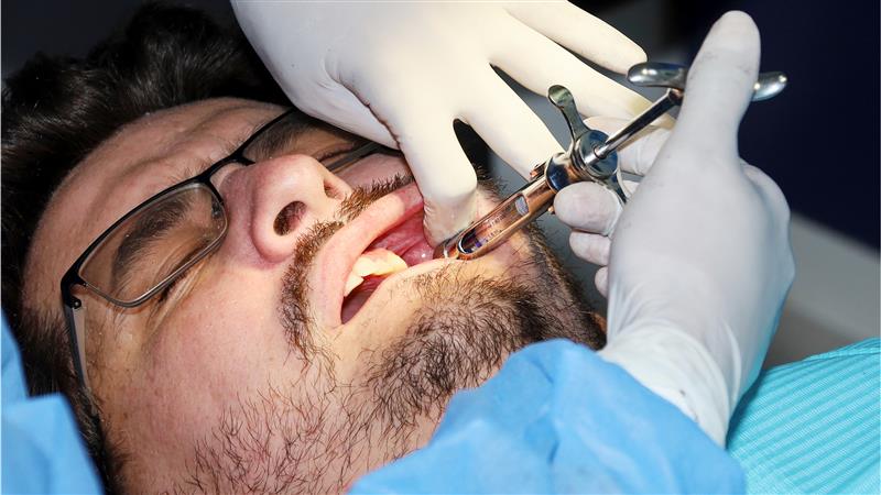 Wisdom Teeth Removal