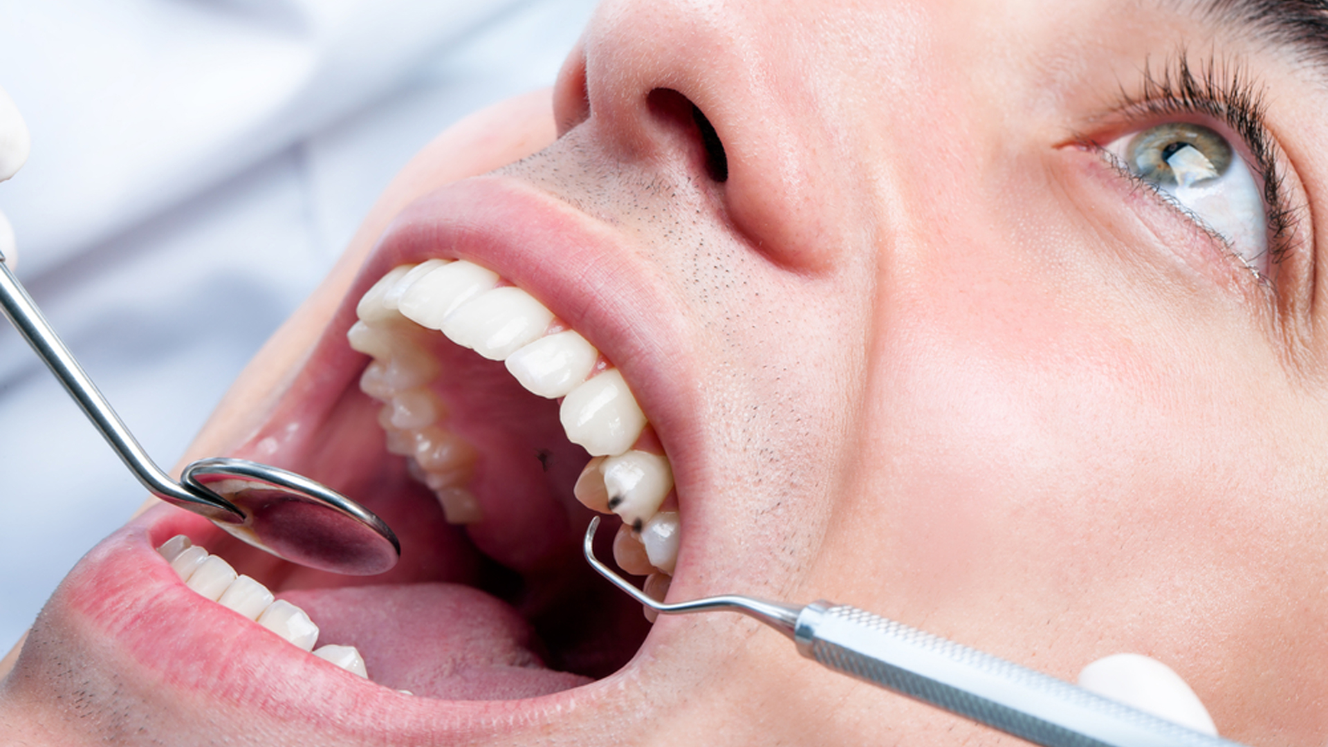 Black Spot on roof of mouth