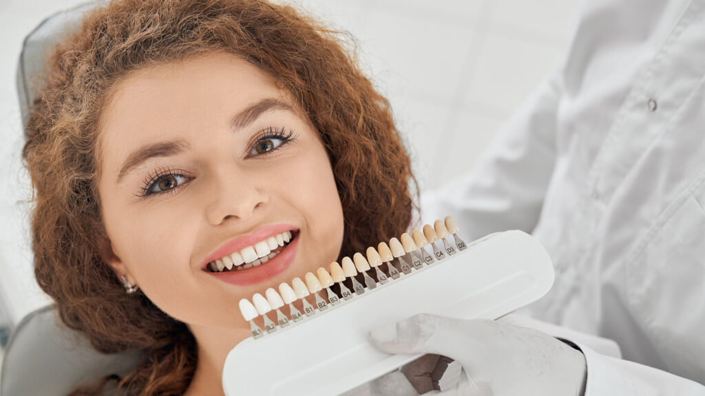 Dental Veneers