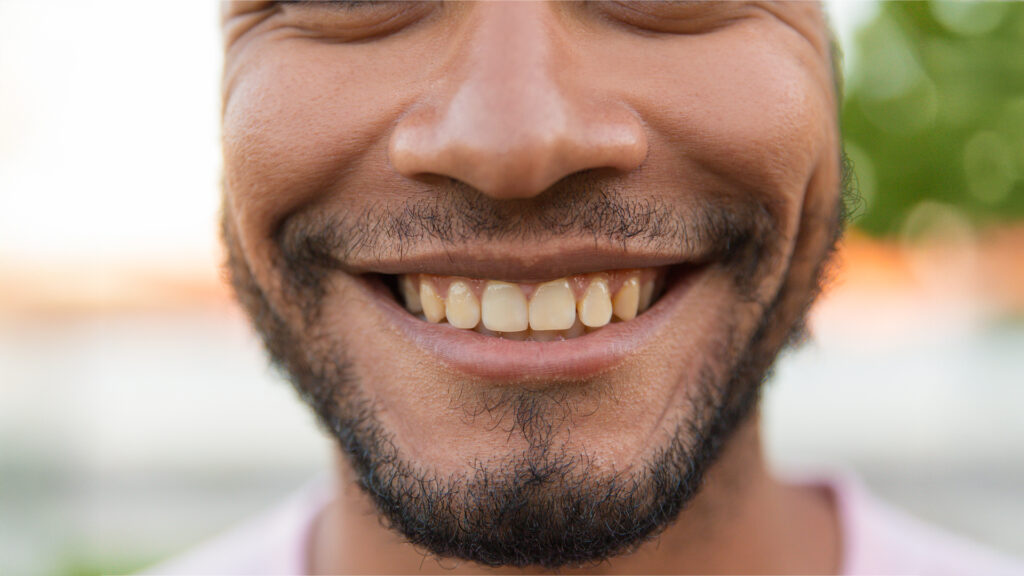 Dental Plaque