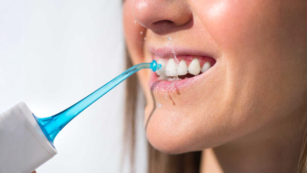 fluoride treatment
